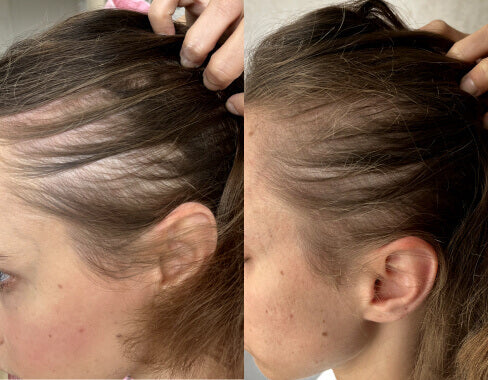 شامبو ثيكلي لتقوية الشعر - لطيف على الفروة الحساسة ويقلل التساقط