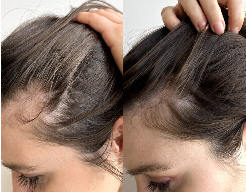 شامبو ثيكلي لتقوية الشعر - لطيف على الفروة الحساسة ويقلل التساقط