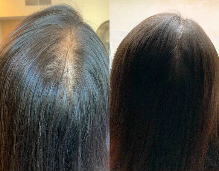 شامبو ثيكلي لتقوية الشعر - لطيف على الفروة الحساسة ويقلل التساقط