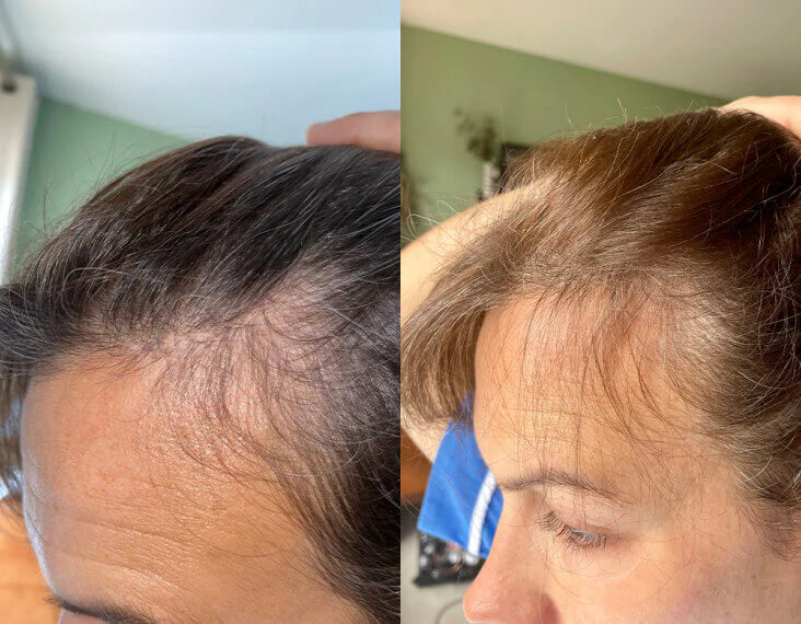 شامبو ثيكلي لتقوية الشعر - لطيف على الفروة الحساسة ويقلل التساقط