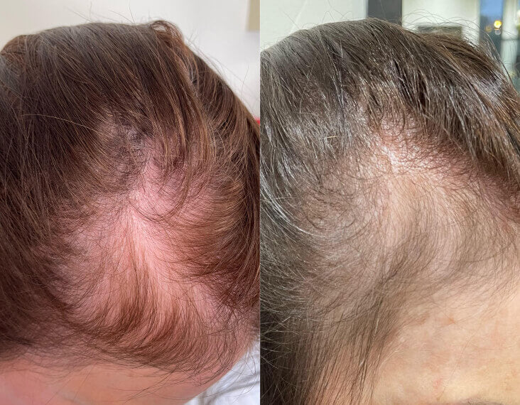 شامبو ثيكلي لتقوية الشعر - لطيف على الفروة الحساسة ويقلل التساقط