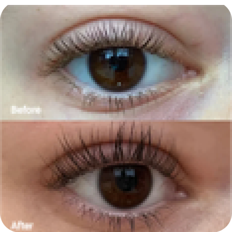 سيروم لتعزيز كثافة الرموش